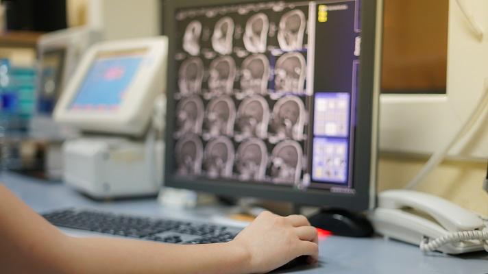 Implementation best practices: Going live with new imaging tech