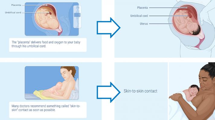 A slide for the maternal health program